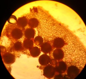 pollen-of-hibiscus-under-microscope